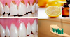 Prevent Tooth Decay and Make Your Teeth White and Strong Only With One Ingredient